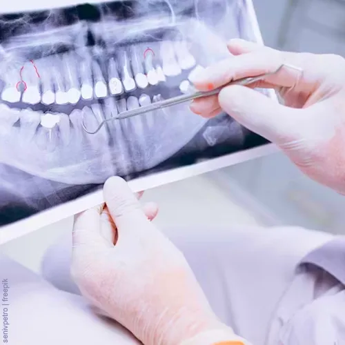 Endodontia